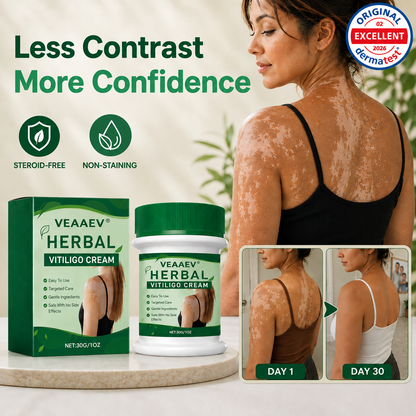 VEAAEV® Herbal Vitiligo Cream