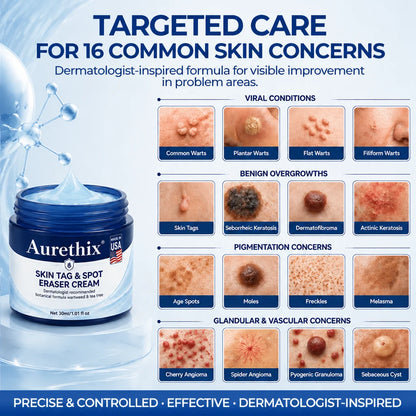 🔥Limited Time 50% OFF🔥 AurethixB7-Day Skin Tag & Spot Eraser Cream