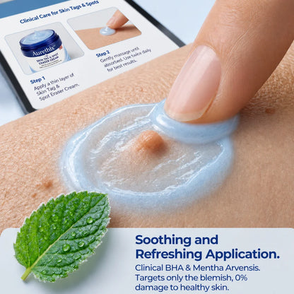 🔥Limited Time 50% OFF🔥 AurethixB7-Day Skin Tag & Spot Eraser Cream